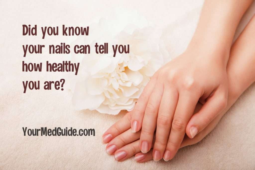 What your nails can tell you about your health