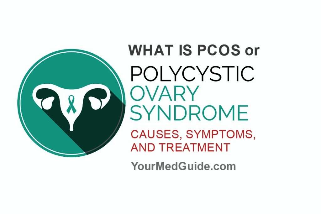 What is PCOS Symptoms Causes Treatment