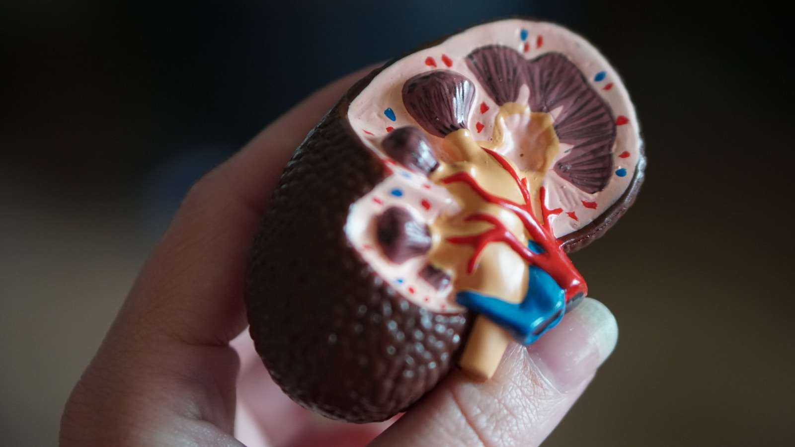 Prevent kidney failure kidney scale model in hand